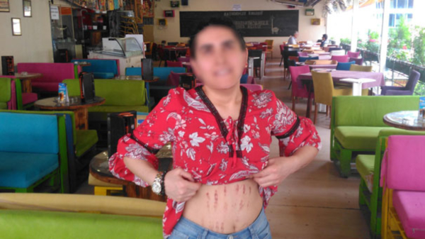 Default Alt